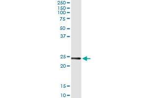 Immunoprecipitation of UBE2T transfected lysate using anti-UBE2T monoclonal antibody and Protein A Magnetic Bead , and immunoblotted with UBE2T MaxPab rabbit polyclonal antibody. (Ube2t Antikörper  (AA 1-197))