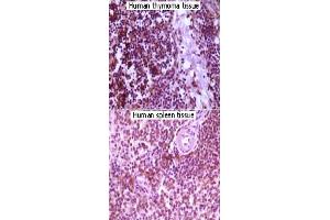 Immunohistochemical analysis of paraffin-embedded lymphocyte of human thymoma and human spleen tissue showing cytoplasmic localization using MAP2K4 monoclonal antibody, clone 2D10D8,4G11B2  with DAB staining. (MAP2K4 Antikörper)