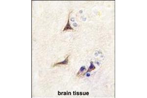 Immunohistochemistry (Paraffin-embedded Sections) (IHC (p)) image for anti-Nerve Growth Factor beta (NGFB) (AA 84-115) antibody (ABIN392194)
