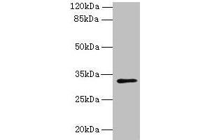 Western blot All lanes: PLPP2 antibody at 8 μg/mL + MCF-7 whole cell lysate Secondary Goat polyclonal to rabbit IgG at 1/10000 dilution Predicted band size: 33, 35, 27 kDa Observed band size: 33 kDa (PPAP2C Antikörper  (AA 109-162))