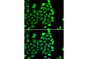 Immunofluorescence analysis of MCF-7 cells using IKZF3 antibody (ABIN4904027).