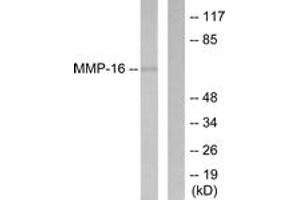 Western blot analysis of extracts from HepG2 cells, using MMP-16 Antibody. (MMP16 Antikörper  (AA 551-600))
