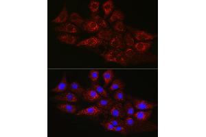 Immunofluorescence analysis of NIH/3T3 cells using CPT2 Rabbit pAb (ABIN6129249, ABIN6138983, ABIN6138984 and ABIN6216045) at dilution of 1:100 (40x lens). (CPT2 Antikörper  (AA 1-180))