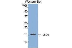 Detection of Recombinant HTN1, Human using Polyclonal Antibody to Histatin 1 (HTN1) (HTN1 Antikörper  (AA 20-57))