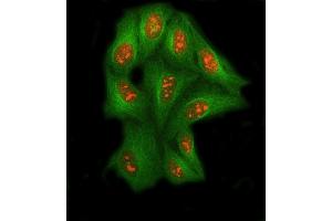IF analysis of SSRP1 using anti-SSRP1 antibody (ABIN7600496) and anti-Tubulin Alpha antibody (ABIN7600339).