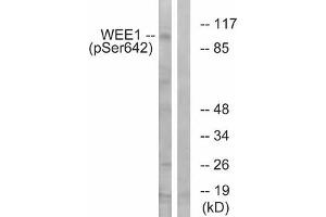 Western blot analysis of extracts from 293 cells treated with etoposide using WEE1 (Phospho-Ser642) Antibody. (WEE1 Antikörper  (pSer642))