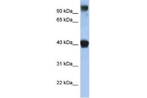 WB Suggested Anti-TFAP2E Antibody Titration:  0. (TFAP2E Antikörper  (N-Term))