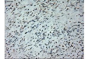 Immunohistochemical staining of paraffin-embedded colon tissue using anti-PROM2mouse monoclonal antibody.