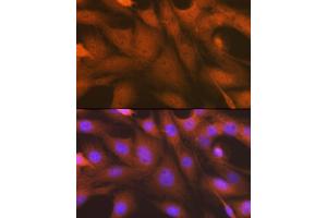 Immunofluorescence analysis of C6 cells using  antibody (ABIN7265552) at dilution of 1:100. (ALKBH1 Antikörper)
