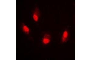 Immunofluorescent analysis of Histone H4 (AcK8) staining in HeLa cells. (Histone H4 Antikörper  (acLys8, N-Term))