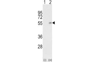 Western Blotting (WB) image for anti-Haptoglobin (HP) antibody (ABIN3003969) (Haptoglobin Antikörper)