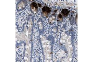 Immunohistochemical staining of human duodenum with C3orf63 polyclonal antibody  shows strong positivity in Paneth and enteroendocrine cells. (FAM208A Antikörper)