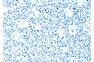 Immunohistochemistry (IHC) image for anti-Poly (ADP-Ribose) Polymerase 1 (PARP1) (AA 215-265) antibody (ABIN7455116)