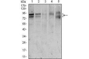 Western blot analysis using FOXP1 mouse mAb against HeLa (1), Jurkat (2), MCF-7 (3), T47D (4), and Raw264. (FOXP1 Antikörper  (AA 481-677))