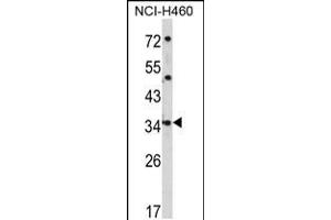 Western blot analysis of CER1 Antibody in NCI-H460 cell line lysates (35ug/lane)