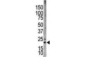Western blot testing of Bim antibody and HL-60 cell lysate (BIM Antikörper  (AA 130-165))