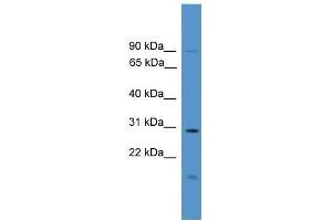 Western Blot showing RASSF1 antibody used at a concentration of 1. (RASSF1 Antikörper  (C-Term))