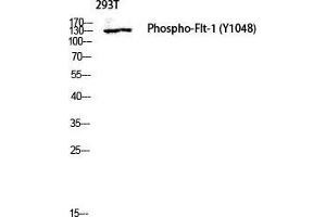 Western Blot (WB) analysis of 293T lysis using Phospho-Flt-1 (Y1048) antibody.