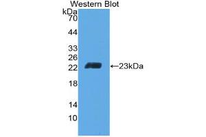 Western blot analysis of the recombinant protein. (CD6 Antikörper  (AA 30-204))