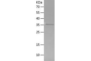 VANGL2 Protein (AA 1-140) (His-IF2DI Tag)