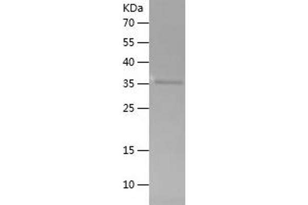 VANGL2 Protein (AA 1-140) (His-IF2DI Tag)