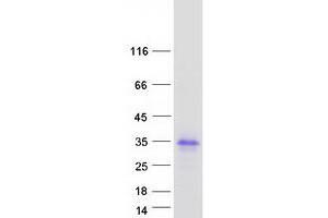 Validation with Western Blot (LDLRAD1 Protein (Myc-DYKDDDDK Tag))