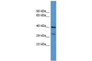 WB Suggested Anti-Dusp11 Antibody Titration: 0. (DUSP11 Antikörper  (N-Term))