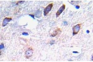 Immunohistochemistry (IHC) analyzes of p-PDGFR beta antibody in paraffin-embedded human brain tissue. (PDGFRB Antikörper  (pTyr751))