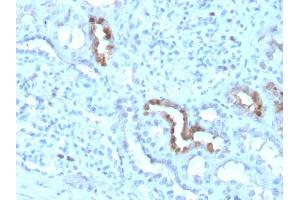 Formalin-fixed, paraffin-embedded human Kidney stained with Calbindin 1 Mouse Monoclonal Antibody (CALB1/3333). (CALB1 Antikörper  (AA 7-96))