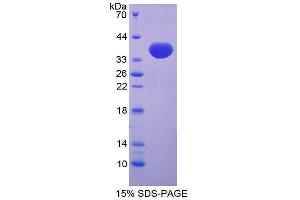 SDS-PAGE (SDS) image for Trefoil Factor 3 (Intestinal) (TFF3) (AA 23-81) protein (His tag,GST tag) (ABIN1171494)