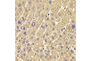 Immunohistochemistry of paraffin-embedded human liver injury using PEX5 antibody (ABIN5973402) at dilution of 1/100 (40x lens). (PEX5 Antikörper)
