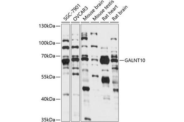 GALNT10 Antikörper  (AA 444-603)