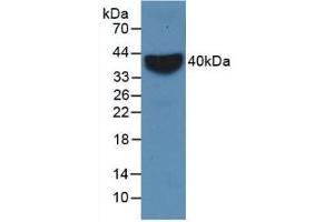 Detection of Recombinant VCAM1, Rabbit using Monoclonal Antibody to Vascular Cell Adhesion Molecule 1 (VCAM1) (VCAM1 Antikörper  (AA 409-682))