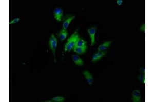 Immunofluorescence staining of Hela cells with ABIN7164700 at 1:33, counter-stained with DAPI. (HBEGF Antikörper  (AA 63-148))