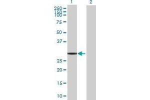 Western Blotting (WB) image for C9orf77 293T Cell Transient Overexpression Lysate(Denatured) (ABIN1336284)