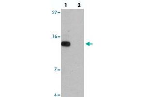 Western blot analysis of DDA1 in mouse heart tissue with DDA1 polyclonal antibody  at 1 ug/mL in (lane 1) the absence and (lane 2) the presence of blocking peptide. (DDA1 Antikörper  (C-Term))