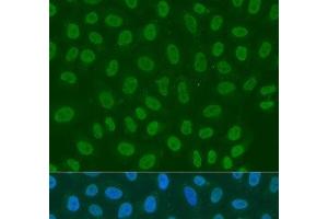 Immunofluorescence analysis of U2OS cells using LSM2 Polyclonal Antibody at dilution of 1:100. (LSM2 Antikörper)