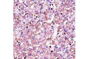 Immunohistochemistry (IHC) image for anti-Insulin-Like Growth Factor 1 (IGF1) (AA 115-144) antibody (ABIN3031342)