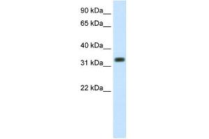 WB Suggested Anti-SIAH1 Antibody Titration:  1. (SIAH1 Antikörper  (C-Term))
