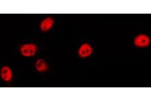 ABIN6274457 staining LOVO by IF/ICC. (EZH1 Antikörper  (Internal Region))