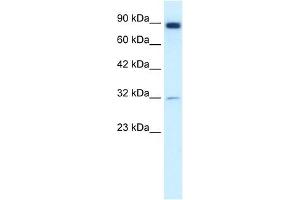 Western Blotting (WB) image for anti-Matrix Metallopeptidase 9 (Gelatinase B, 92kDa Gelatinase, 92kDa Type IV Collagenase) (MMP9) antibody (ABIN630147)