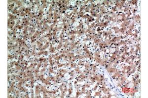 Immunohistochemistry (IHC) analysis of paraffin-embedded Human Liver, antibody was diluted at 1:100.