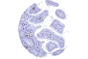IgA positive plasma cells are abundant in the duodenum mucosa (Rekombinanter Kaninchen anti-Human IgA Antikörper)