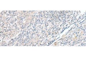 Immunohistochemistry of paraffin-embedded Human tonsil tissue using POMGNT1 Polyclonal Antibody at dilution of 1:55(x200)