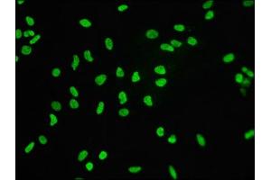 Immunofluorescence staining of Hela cells with ABIN7127296 at 1:60,counter-stained with DAPI. (Rekombinanter Histone H3.3 Antikörper)