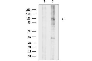 Western blot analysis of lysates from PC12(H2O2 treatment), using TGF beta Receptor III Antibody.