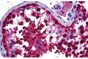 Human Testis: Formalin-Fixed, Paraffin-Embedded (FFPE) (CCT5 Antikörper  (AA 1-542))