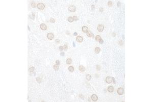 Immunohistochemistry (IHC) image for anti-WD Repeat and FYVE Domain Containing 3 (WDFY3) (AA 500-550) antibody (ABIN7448861) (WDFY3 Antikörper  (AA 500-550))