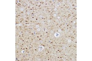 Immunohistochemistry of paraffin-embedded rat brain using Caspase-6 Rabbit mAb (ABIN7266119) at dilution of 1:100 (40x lens). (Caspase 6 Antikörper)