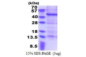 SDS-PAGE (SDS) image for Melanoma Antigen Family B, 10 (MAGEB10) (AA 1-347) protein (His tag) (ABIN6387325)